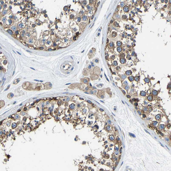 G3BP2 Antibody in Immunohistochemistry (IHC)