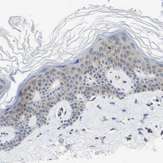 G3BP2 Antibody in Immunohistochemistry (IHC)