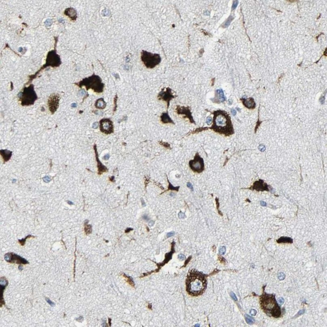 G3BP2 Antibody in Immunohistochemistry (IHC)