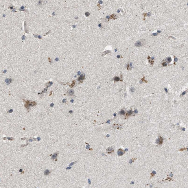 PDP1 Antibody in Immunohistochemistry (IHC)