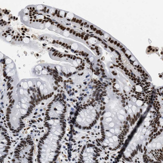 LUC7L3 Antibody in Immunohistochemistry (IHC)