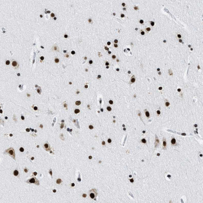 LUC7L3 Antibody in Immunohistochemistry (IHC)