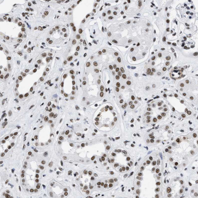 LUC7L3 Antibody in Immunohistochemistry (IHC)