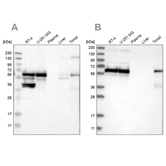 LUC7L3 Antibody in Western Blot (WB)