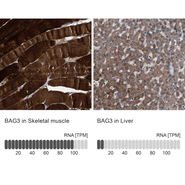 BAG3 Antibody in Immunohistochemistry (IHC)