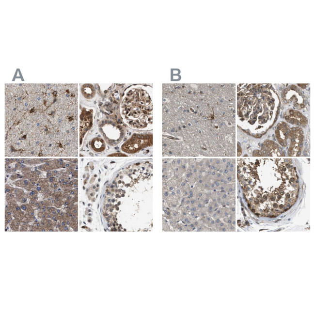 BAG3 Antibody in Immunohistochemistry (IHC)