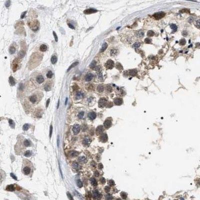 BAG3 Antibody in Immunohistochemistry (IHC)