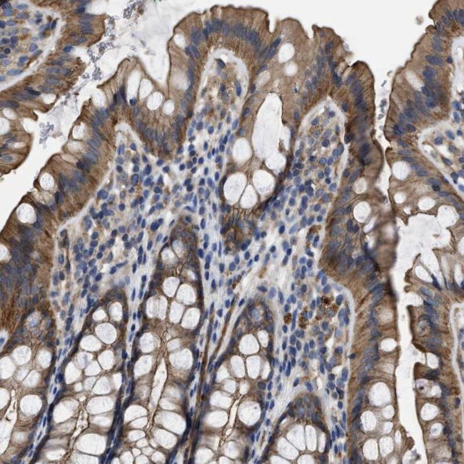 USP4 Antibody in Immunohistochemistry (IHC)