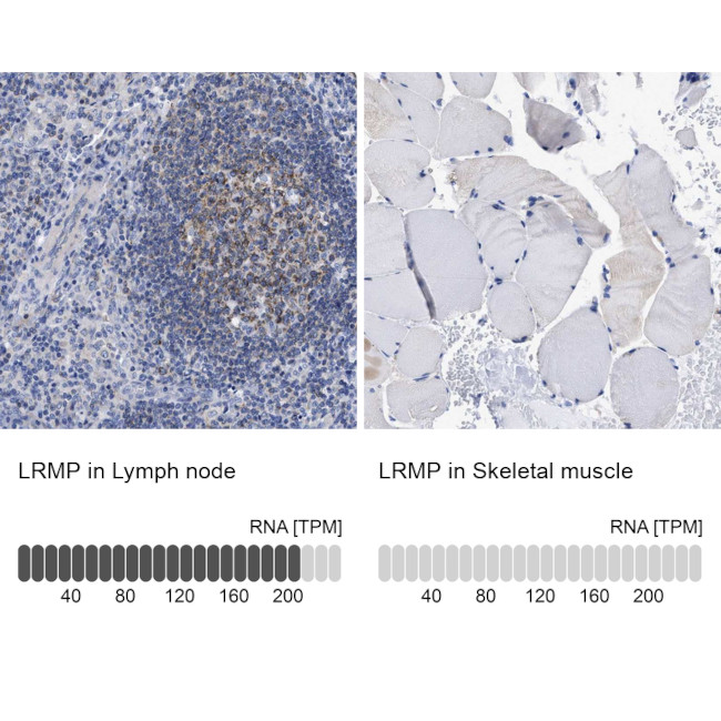 Lrmp Antibody in Immunohistochemistry (IHC)