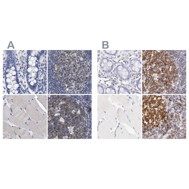 Lrmp Antibody in Immunohistochemistry (IHC)