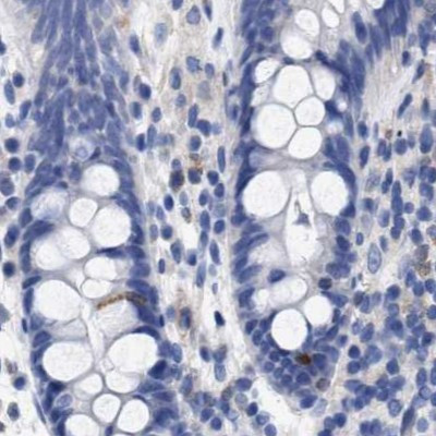 Lrmp Antibody in Immunohistochemistry (IHC)