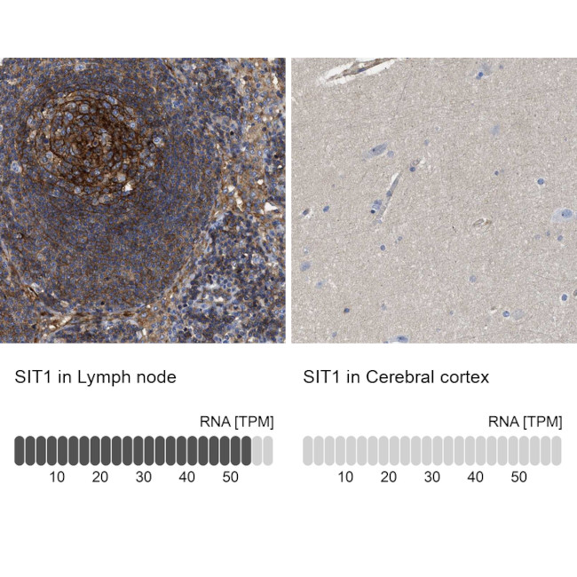 SIT Antibody in Immunohistochemistry (IHC)