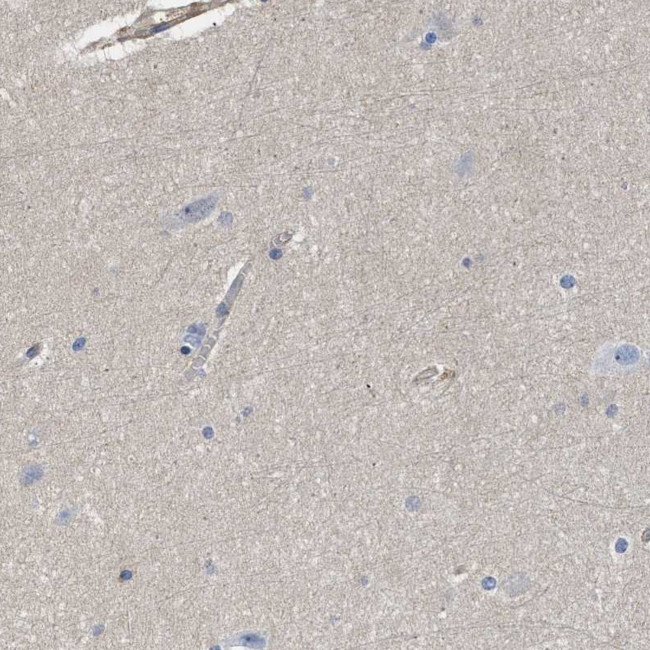 SIT Antibody in Immunohistochemistry (IHC)