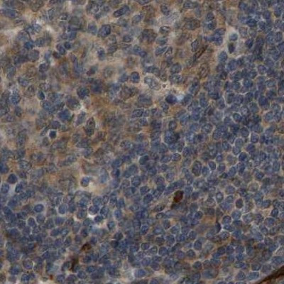 TCP-1 theta Antibody in Immunohistochemistry (IHC)