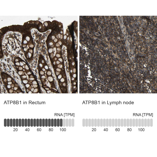 ATP8B1 Antibody in Immunohistochemistry (IHC)