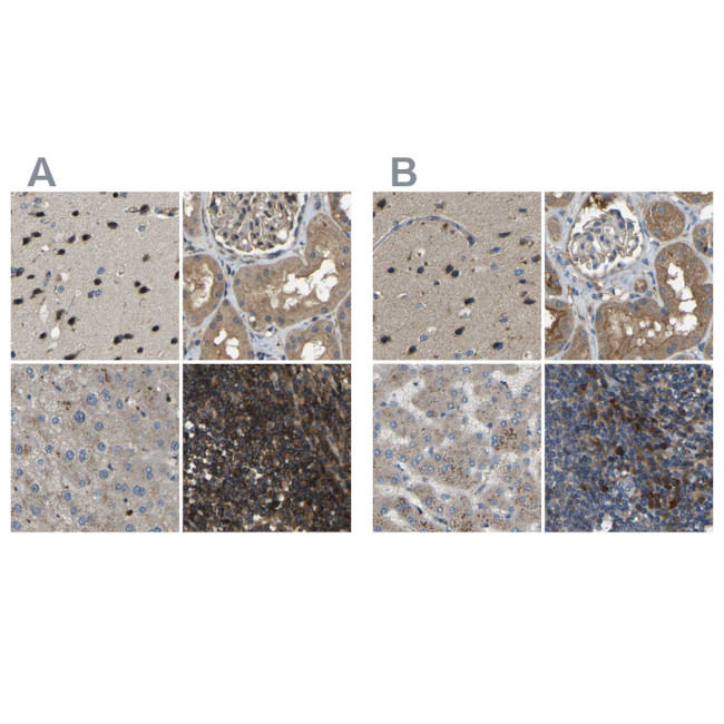 ATP8B1 Antibody in Immunohistochemistry (IHC)