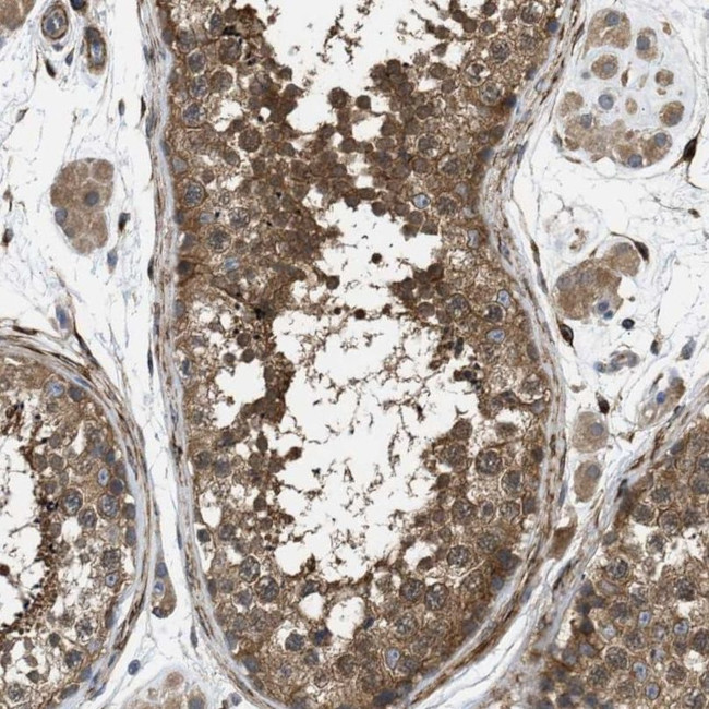 CHKB Antibody in Immunohistochemistry (IHC)