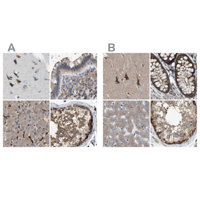 GCN1L1 Antibody in Immunohistochemistry (IHC)