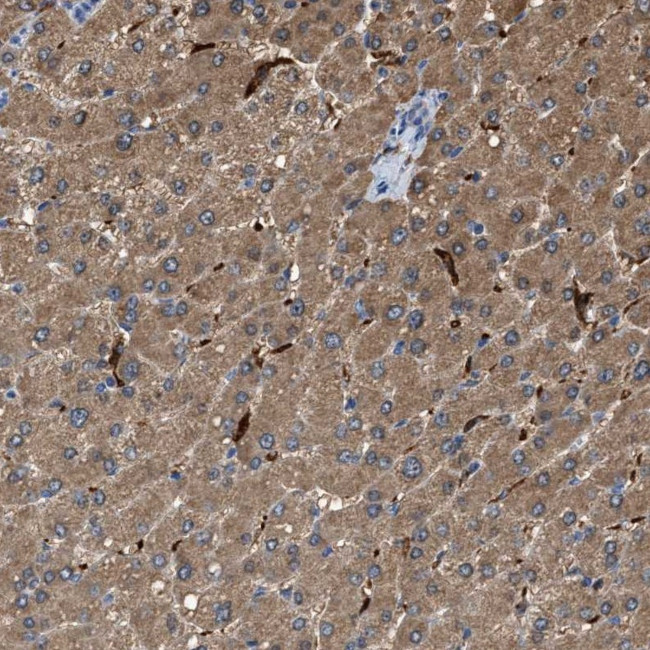 GCN1L1 Antibody in Immunohistochemistry (IHC)