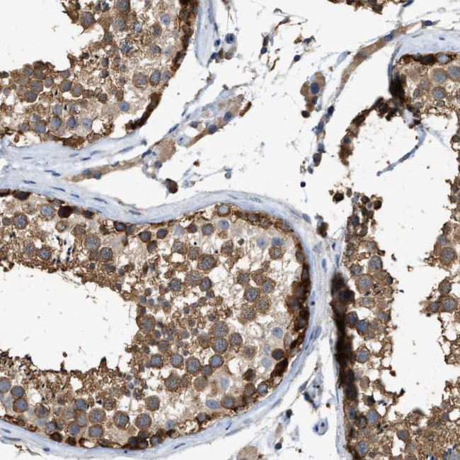 GCN1L1 Antibody in Immunohistochemistry (IHC)