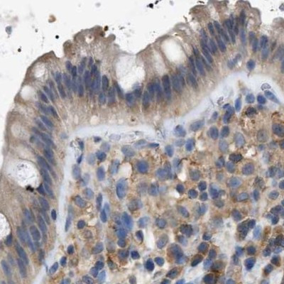 GCN1L1 Antibody in Immunohistochemistry (IHC)