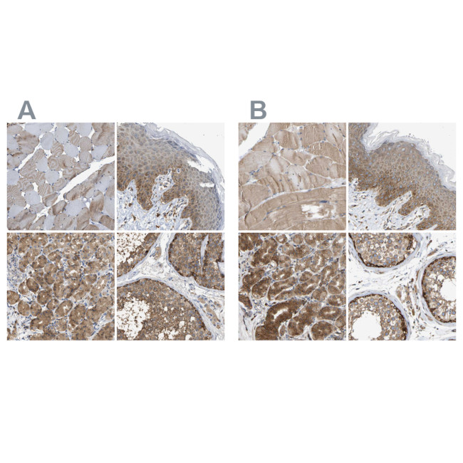 GCN1L1 Antibody