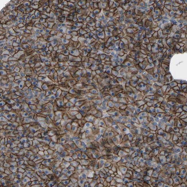 SLC43A1 Antibody in Immunohistochemistry (IHC)