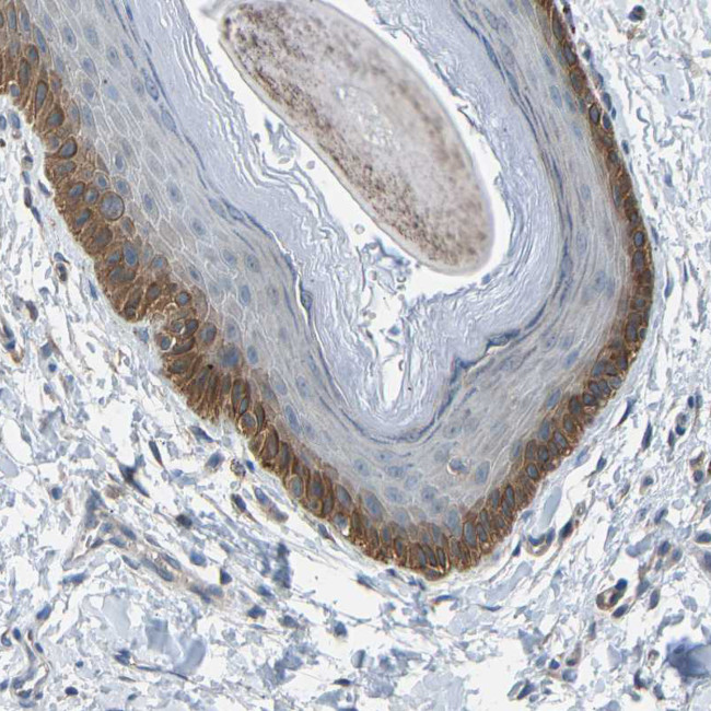 SLC43A1 Antibody in Immunohistochemistry (IHC)