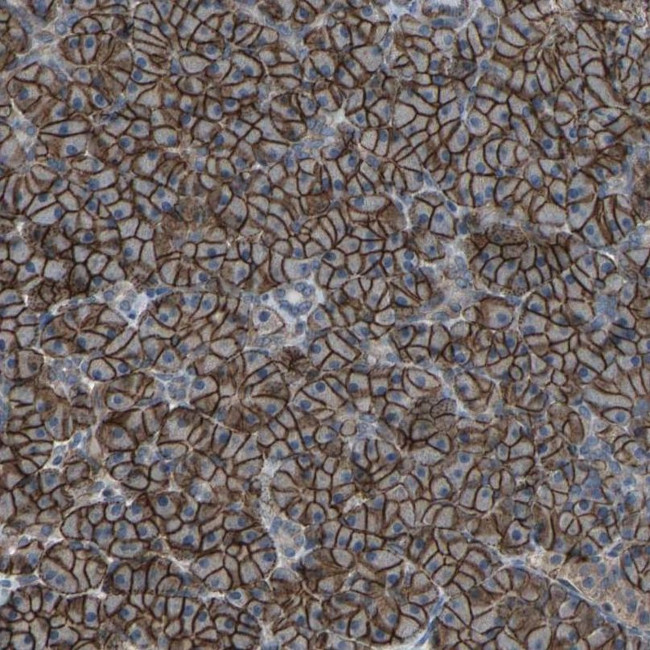 SLC43A1 Antibody in Immunohistochemistry (IHC)