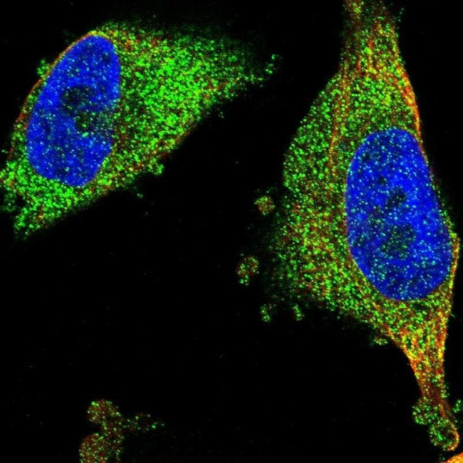 FNTA Antibody in Immunocytochemistry (ICC/IF)