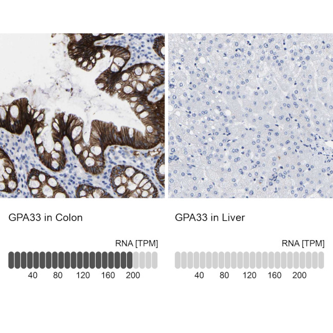 A33 Antibody in Immunohistochemistry (IHC)