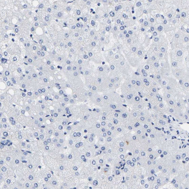 A33 Antibody in Immunohistochemistry (IHC)