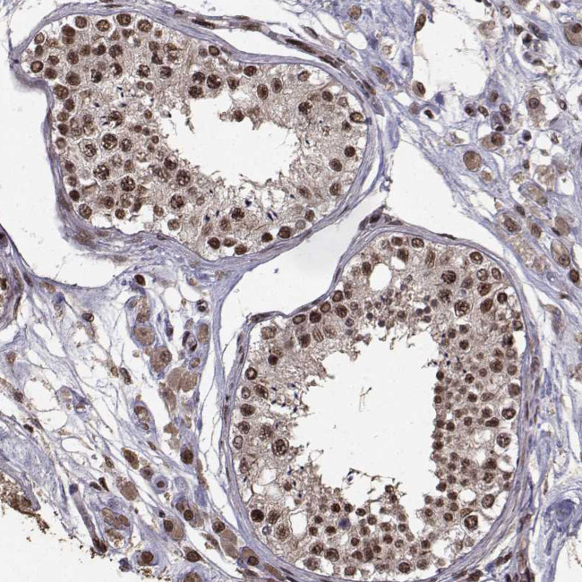 SF1 Antibody in Immunohistochemistry (IHC)