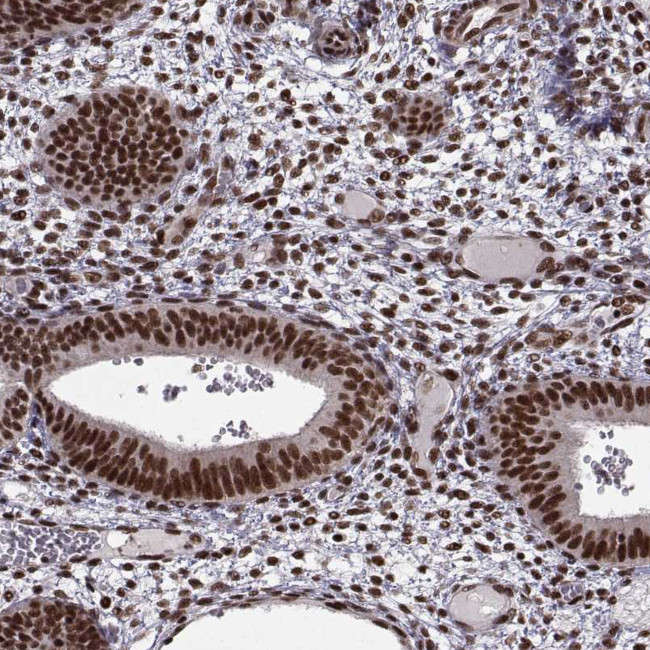 SF1 Antibody in Immunohistochemistry (IHC)