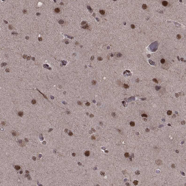 SF1 Antibody in Immunohistochemistry (IHC)