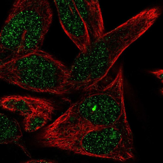 ST6GALNAC6 Antibody in Immunocytochemistry (ICC/IF)