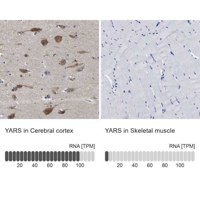 YARS Antibody in Immunohistochemistry (IHC)