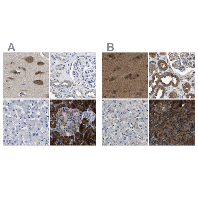 YARS Antibody in Immunohistochemistry (IHC)