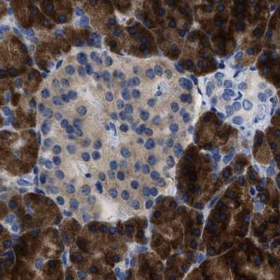 YARS Antibody in Immunohistochemistry (IHC)