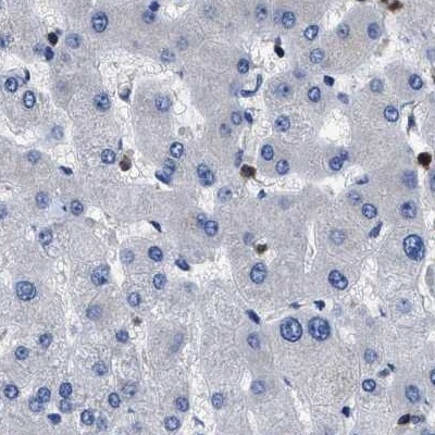 YARS Antibody in Immunohistochemistry (IHC)