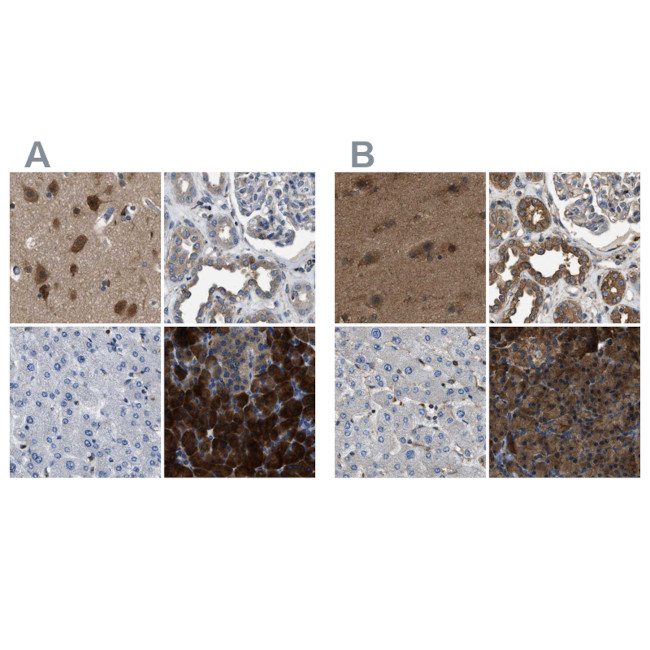 YARS Antibody in Immunohistochemistry (IHC)