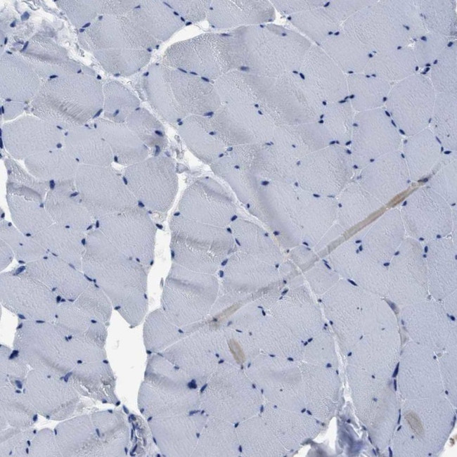 YARS Antibody in Immunohistochemistry (IHC)