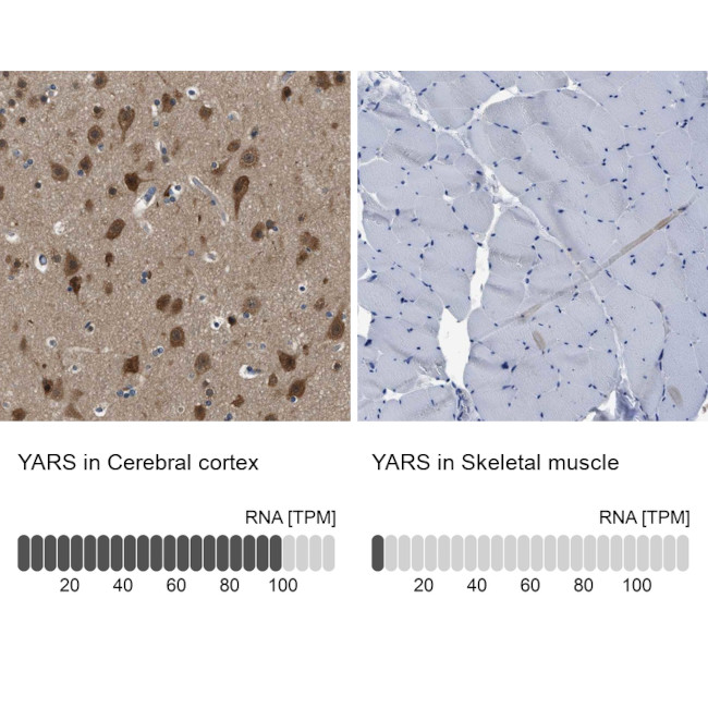 YARS Antibody