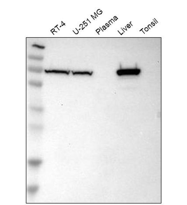 SLC25A13 Antibody in Western Blot (WB)