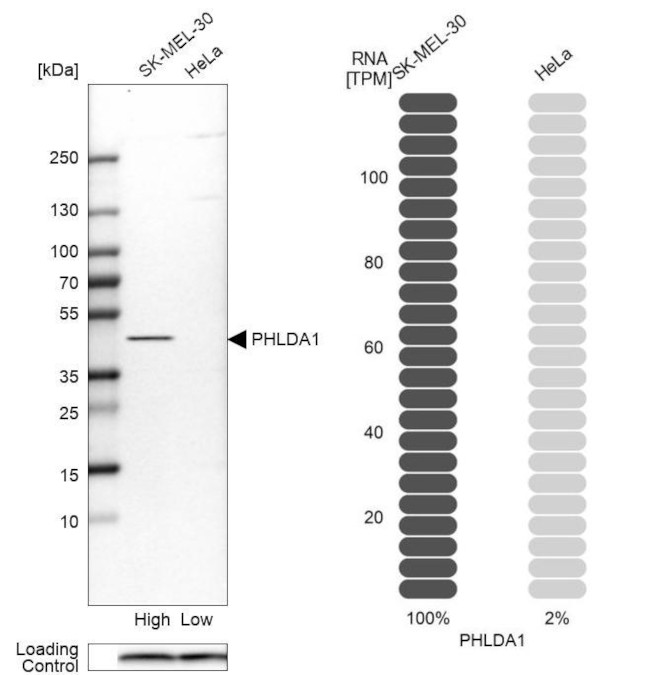 PHLDA1 Antibody