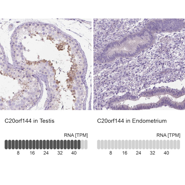C20orf144 Antibody in Immunohistochemistry (IHC)