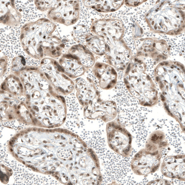 TET1 Antibody in Immunohistochemistry (IHC)