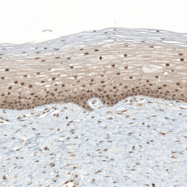 TET1 Antibody in Immunohistochemistry (IHC)