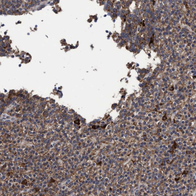 COBL Antibody in Immunohistochemistry (IHC)