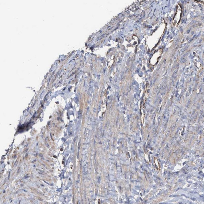 COBL Antibody in Immunohistochemistry (IHC)